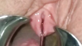 Extreme BDSM Female Urethral Stretching Medical Fetish Speculum Peehole Play