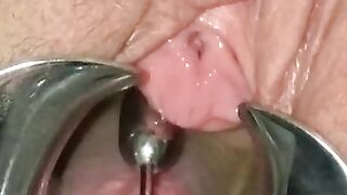 Extreme BDSM Female Urethral Stretching Medical Fetish Speculum Peehole Play